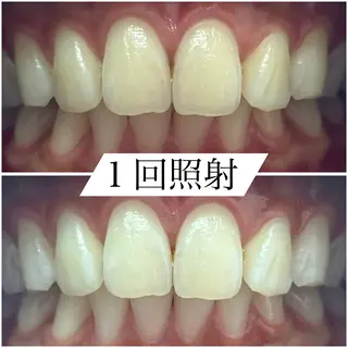 White base ホワイトニングサロンのその他イメージ