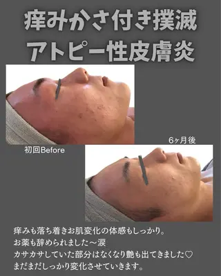 BLOSSOM 菊地のエステ・リラクイメージ