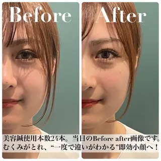 美容鍼/小顔&整体 nano.faceのエステ・リラクイメージ