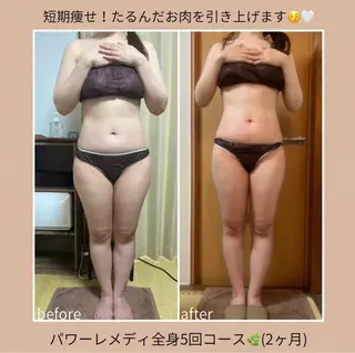 《本気痩せ×疲労改善 》  BILOOPのエステ・リラクイメージ
