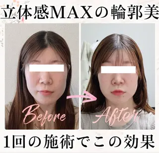 小顔矯正専門 🪽アシュネ平野のエステ・リラクイメージ