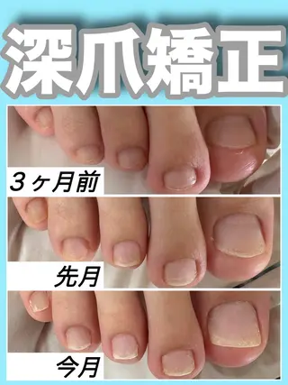 ネイル nail salon petillantのネイルデザイン