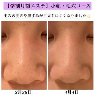 Bellesthe (ベルエステ)のエステ・リラクイメージ