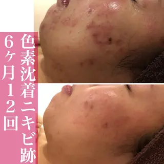 ミディアム カラー パーマ ヘアアレンジ メンズ キッズ ネイル マツエク・マツパ ニキビ・肌質改善専門 ♡人生が変わるサロンのエステ・リラクイメージ