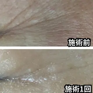 はが ゆかのエステ・リラクイメージ