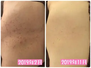 ミディアム カラー パーマ ヘアアレンジ メンズ キッズ ネイル マツエク・マツパ ニキビ・肌質改善専門 ♡人生が変わるサロンのエステ・リラクイメージ