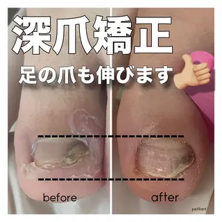 ネイル nail salon petillantのネイルデザイン