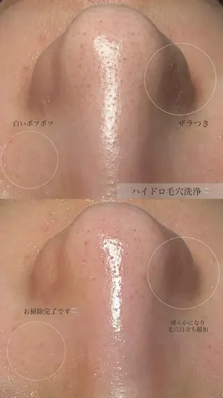 トータルボディケア chouchouのその他イメージ