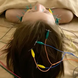 美容鍼WINBACK サロンRemeのエステ・リラクイメージ