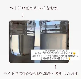 【頭痛、睡眠改善】 salon RUUのエステ・リラクイメージ