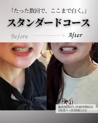 歯科提携エラン ホワイトニング一社店のその他イメージ