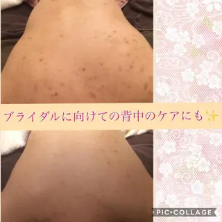 ショート カラー パーマ ヘアアレンジ メンズ キッズ ネイル マツエク・マツパ ニキビ・肌質改善専門 ♡人生が変わるサロンのエステ・リラクイメージ
