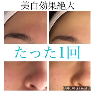 ロング カラー パーマ ヘアアレンジ キッズ ネイル マツエク・マツパ EnsorClair 代表 野口真央のエステ・リラクイメージ