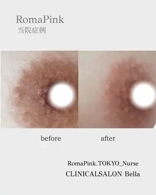 たるみほうれい線ケア 看護師サロンのエステ・リラクイメージ