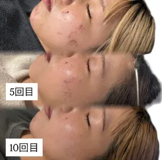 🌱美Plus下北沢 肌質改善/まつ毛のマツエク・マツパデザイン