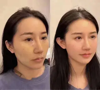 ネイル 愛維美水光専門店 川崎彩鳳のエステ・リラクイメージ