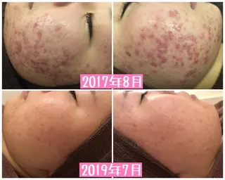 ミディアム カラー パーマ ヘアアレンジ メンズ キッズ ネイル マツエク・マツパ ニキビ・肌質改善専門 ♡人生が変わるサロンのエステ・リラクイメージ
