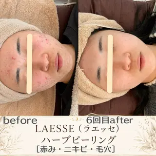 最速小顔・肌管理 espoir 阿部のエステ・リラクイメージ