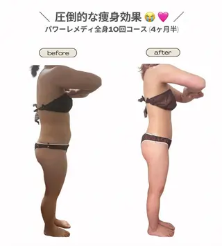 《本気痩せ×疲労改善 》  BILOOPのエステ・リラクイメージ