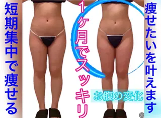 痩身ダイエット&小顔 🩷アールズスリムのエステ・リラクイメージ