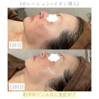 【Folche 春日店】馬場・大内田のエステ・リラクイメージ