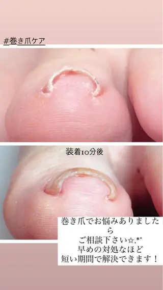 ネイル Amy nail care salonのネイルデザイン