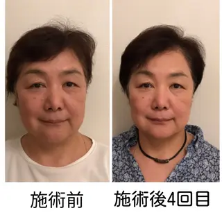 町田・鶴川 小顔矯正 /鈴木友実のエステ・リラクイメージ