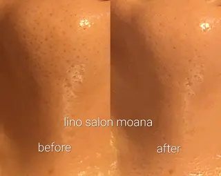 lino salon  moanaのエステ・リラクイメージ