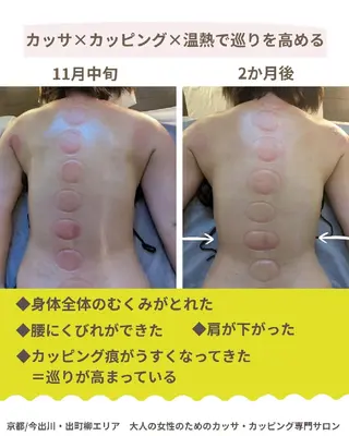 カッサ・カッピング 専門サロン/水玉屋のエステ・リラクイメージ