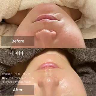 メンズ キッズ 美肌と癒しのサロン Lu,Mieのエステ・リラクイメージ