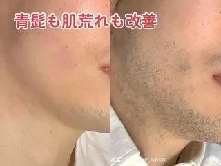 メンズ 高崎 竜太郎のエステ・リラクイメージ