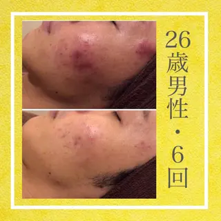 ミディアム カラー パーマ ヘアアレンジ メンズ キッズ ネイル マツエク・マツパ ニキビ・肌質改善専門 ♡人生が変わるサロンのエステ・リラクイメージ