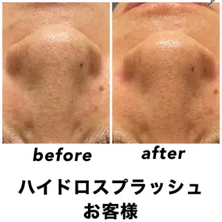 ネイル・エステサロン UILANIのエステ・リラクイメージ
