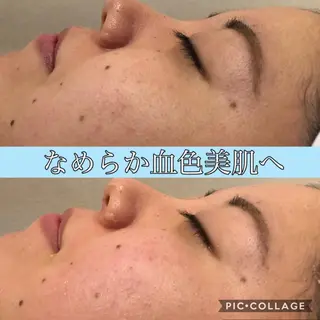 セミロング カラー パーマ ヘアアレンジ キッズ ネイル マツエク・マツパ EnsorClair 代表 野口真央のエステ・リラクイメージ