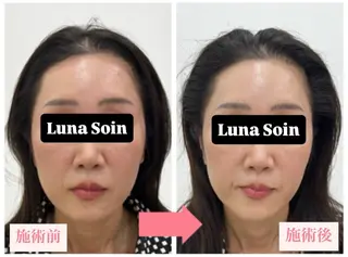 Luna Soinのエステ・リラクイメージ
