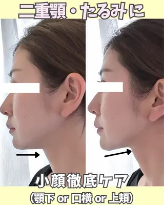 |肌質改善| soina神楽坂のエステ・リラクイメージ