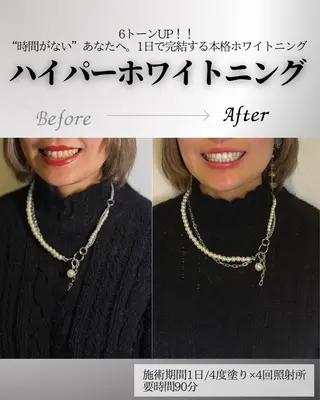 歯科提携エラン ホワイトニング一社店のその他イメージ