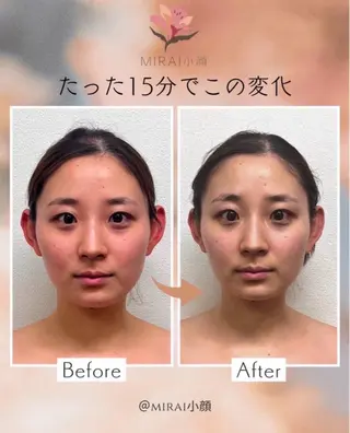 MIRAI小顔名古屋 YUIのエステ・リラクイメージ