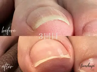 ネイル tumehapi junaのネイルデザイン