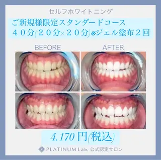 ホワイトニングビュー ティー西宮店のその他イメージ