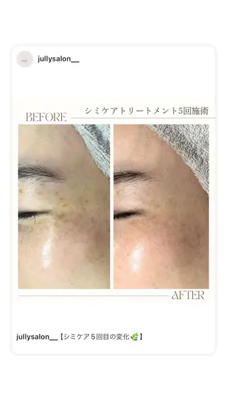 シミケア・肌育サロン Jullyのエステ・リラクイメージ