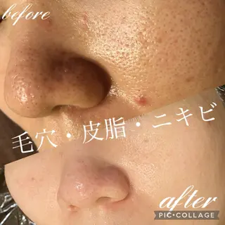 EnsorClair 代表　野口真央のエステ・リラクイメージ