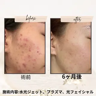 マツエク・マツパ 愛維美水光専門店 川崎彩鳳のエステ・リラクイメージ