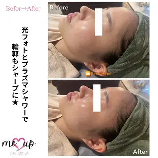 Meupニキビ専門店 背中/ハーブ/肌管理のその他イメージ