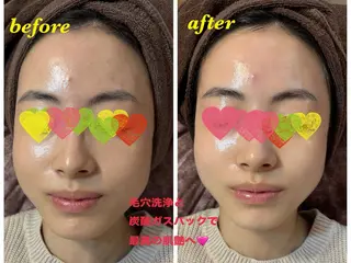 美肌❤️美眉 結果重視サロン✨のエステ・リラクイメージ