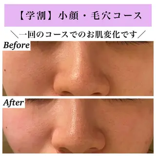 Bellesthe (ベルエステ)のエステ・リラクイメージ