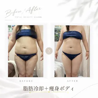《 痩身専門 》 addissimoのエステ・リラクイメージ