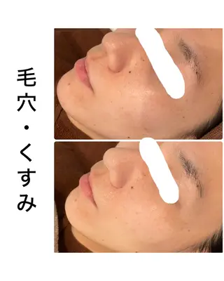 ハーブピーリング専門 BIOPLUS+川崎のエステ・リラクイメージ