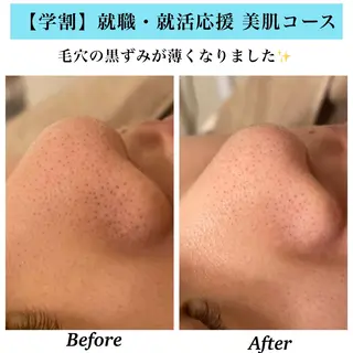 Bellesthe (ベルエステ)のエステ・リラクイメージ