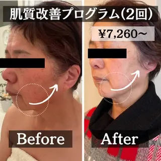 羽賀 茉衣子のエステ・リラクイメージ